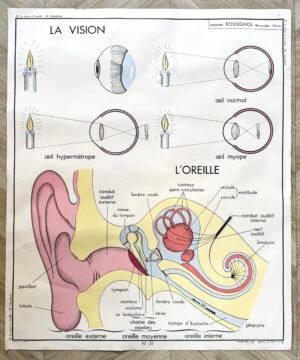 AFFICHE SCOLAIRE VISION / ALCOOLISME