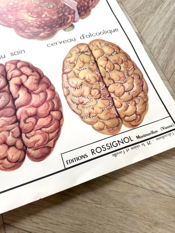 IMG_9101 AFFICHE SCOLAIRE VISION / ALCOOLISME