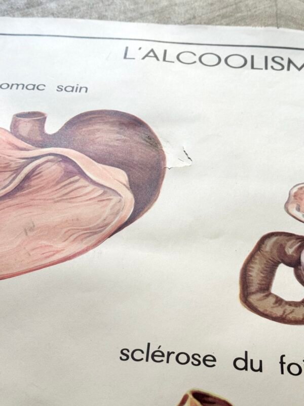 IMG_9102 AFFICHE SCOLAIRE VISION / ALCOOLISME