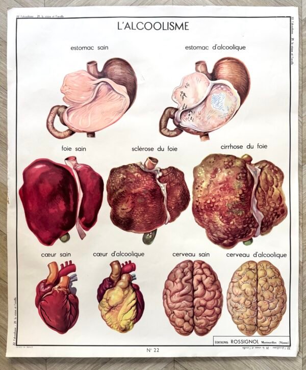 IMG_9103 AFFICHE SCOLAIRE VISION / ALCOOLISME